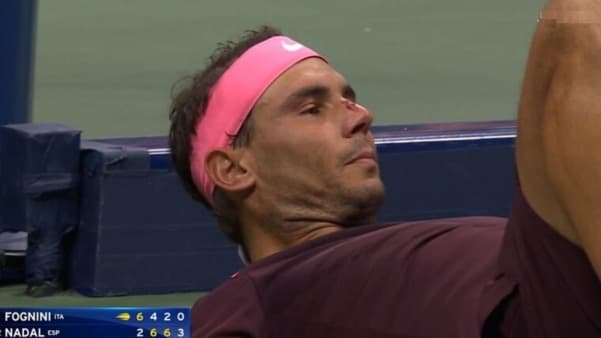 الدماء تغطي وجه نادال في بطولة اميركا المفتوحة